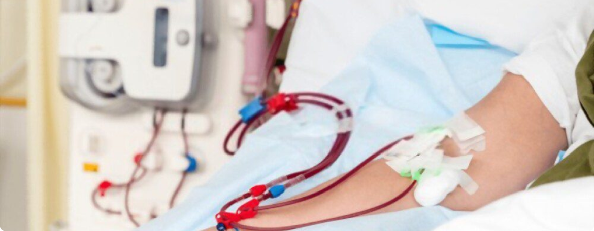 Hemodiafiltração (HDF)