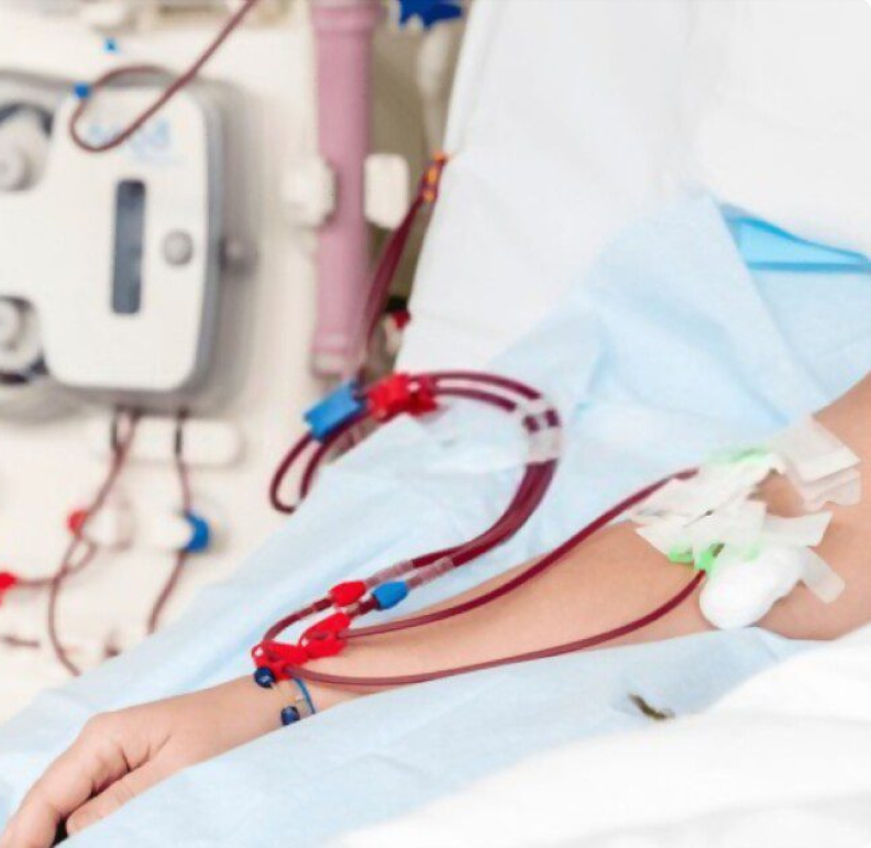 Hemodiafiltração (HDF)