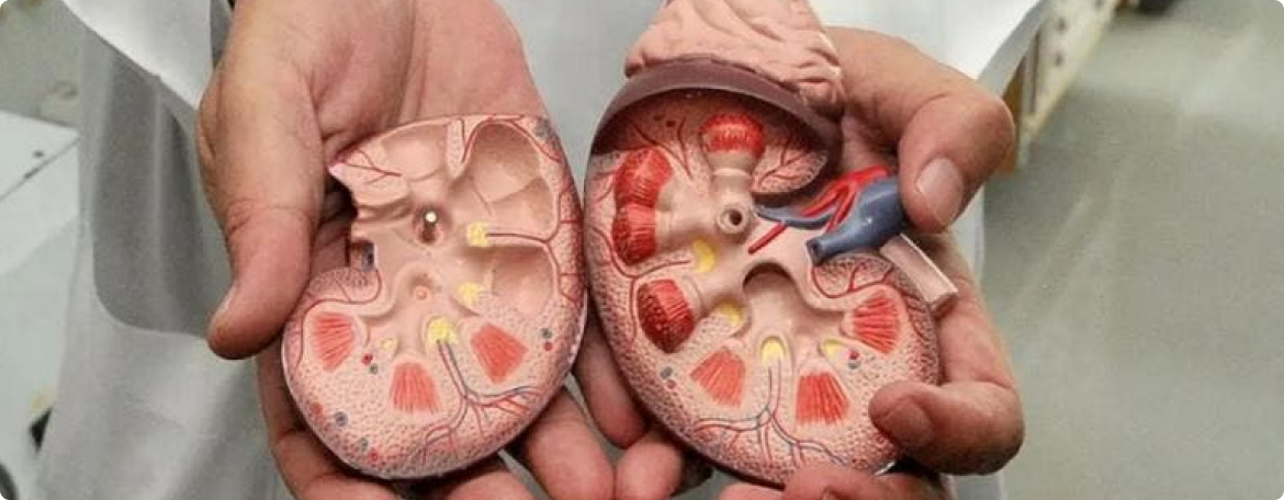 Terapias Renais e Transplantes